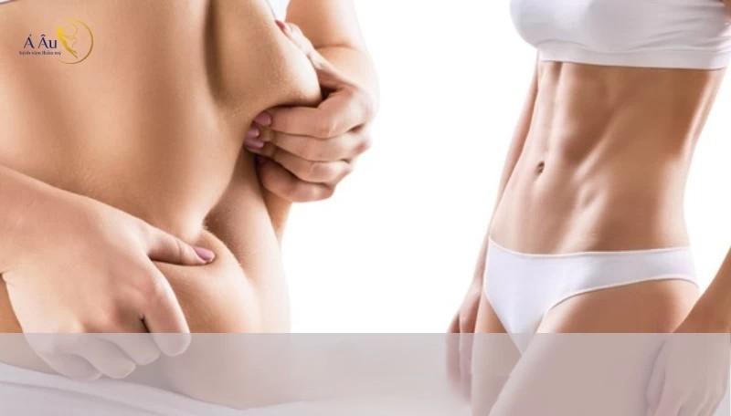 Sau Phẫu Thuật Thẩm Mỹ Có Cần Mặc Đồ Lót Định Hình Không??Có 05 Lý Do Sau Đây 31 So sánh vóc dáng trước và sau phẫu thuật thẩm mỹ – vùng bụng chảy xệ được cải thiện thành bụng thon gọn, săn chắc nhờ sử dụng đồ định hình hậu phẫu.