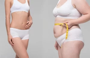 kết quả sau phẫu thuật và kết hợp đồ lót định hình an chery chính hãng Giữ kết quả hút mỡ bụng lâu dài nhờ đồ định hình-