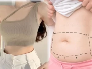Hướng Dẫn Chọn Đồ Lót Định Hình Sau Phẫu Thuật Hướng Dẫn Chọn Đồ Lót Định Hình Sau Phẫu Thuật